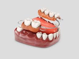 6 TOOTH DENTURE