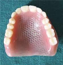 Full Upper Denture