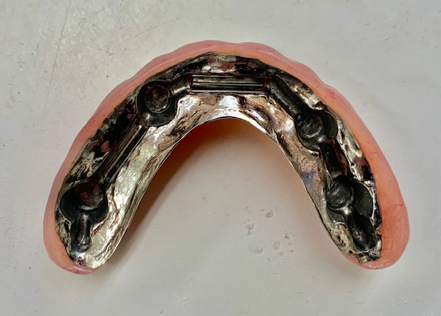 C/C FULL DENTURE