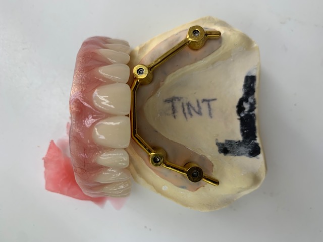 DENTURE ON PRECI LINE