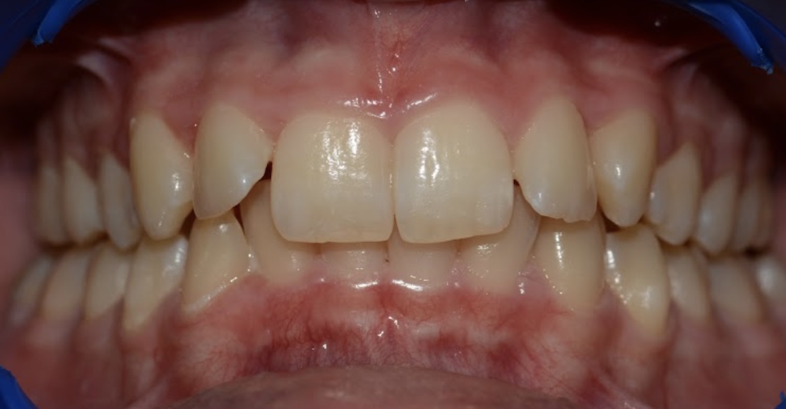 gingival colors 2