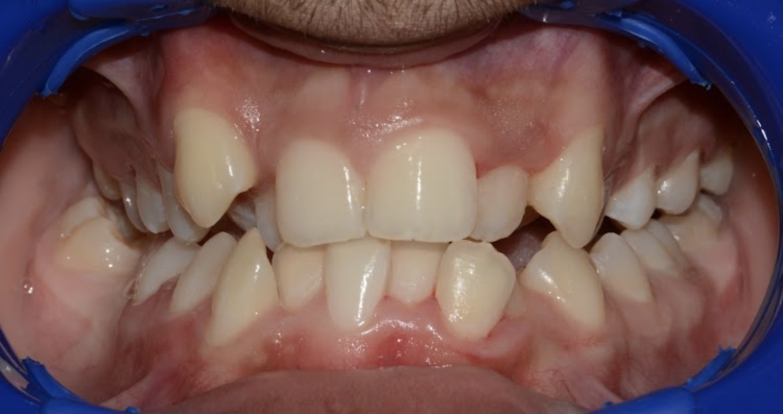 gingival colors 4